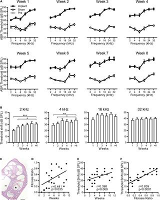 Long-Term Release of Dexamethasone With a Polycaprolactone-Coated Electrode Alleviates Fibrosis in Cochlear Implantation